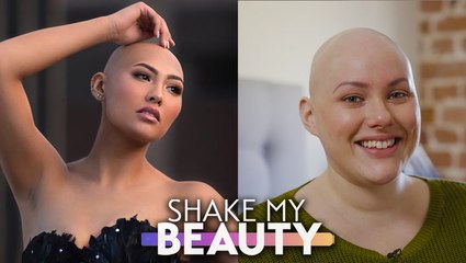 We're Bald and Beautiful: Inspiring Stories of Women with Alopecia ✨