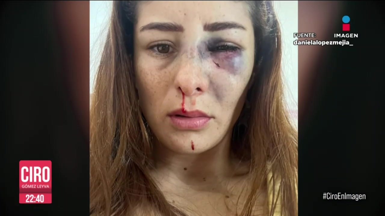 Luchadora Daniela López denuncia a su pareja de haberla agredido