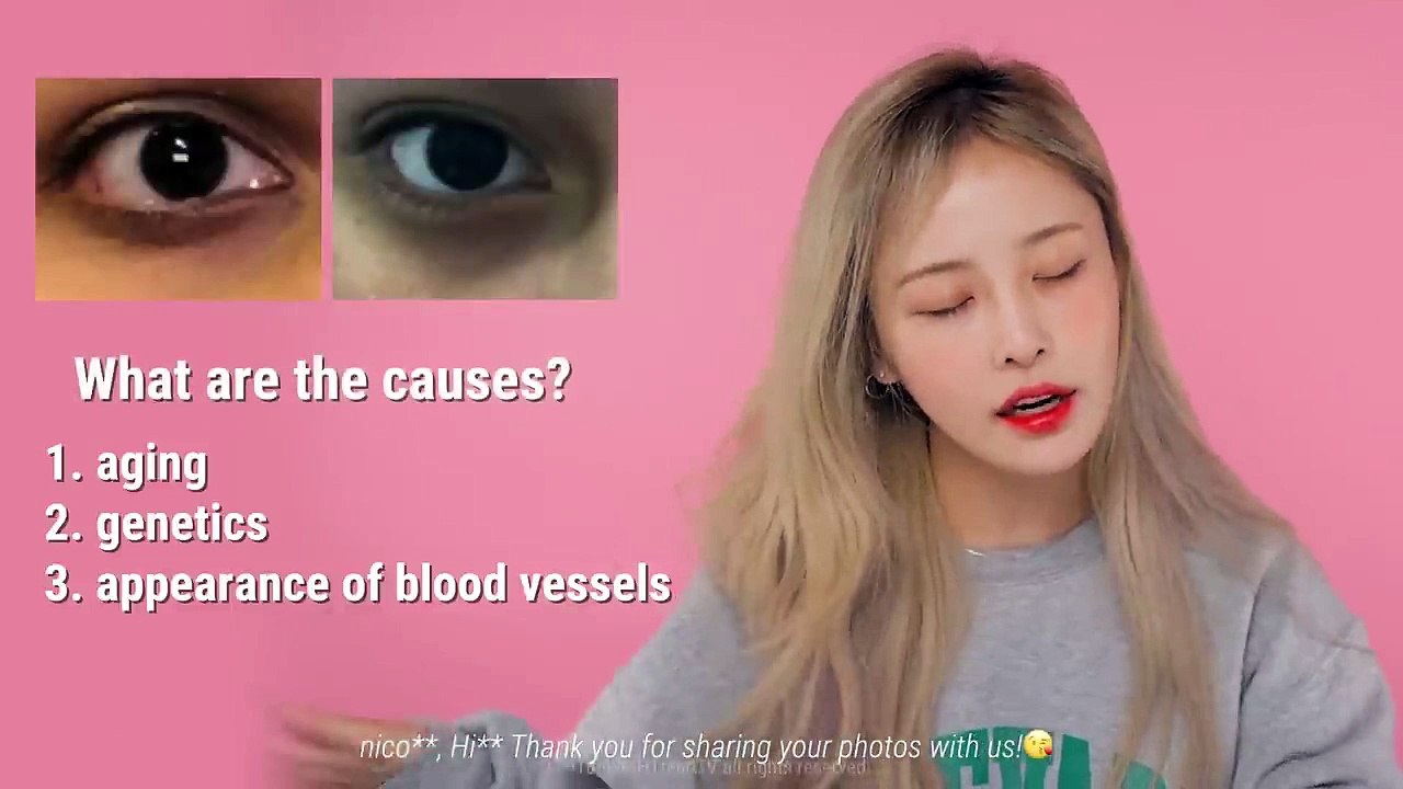 How to Remove Dark Circles Under Eyes In The Most Effective Way! _ Teen Beauty Bible video