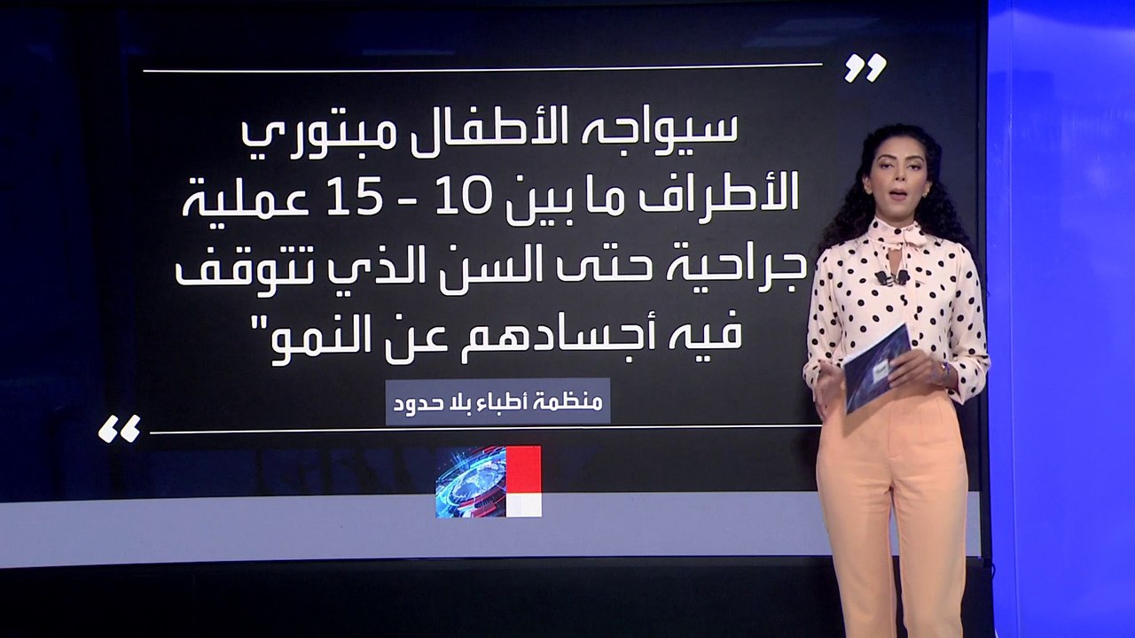 طبيب فلسطيني: أجريت 6 عمليات بتر أطراف في ليلة واحدة وبعضها دون تخدير