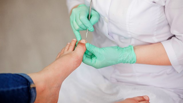 bd-cuidados-para-pie-diabetico-301123