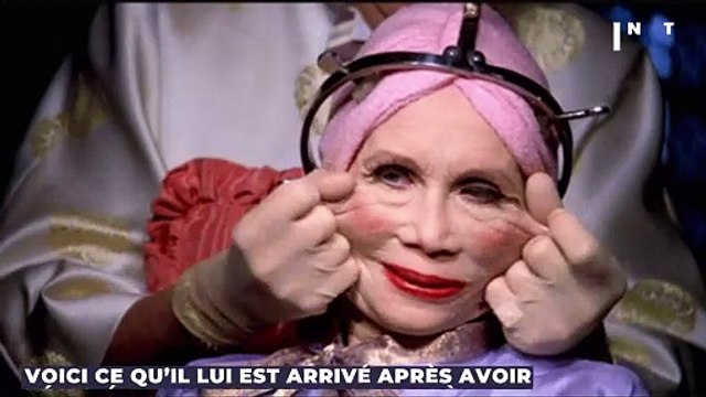 Regardez ce qu’il lui est arrivé après avoir réalisé des injections dans les lèvres