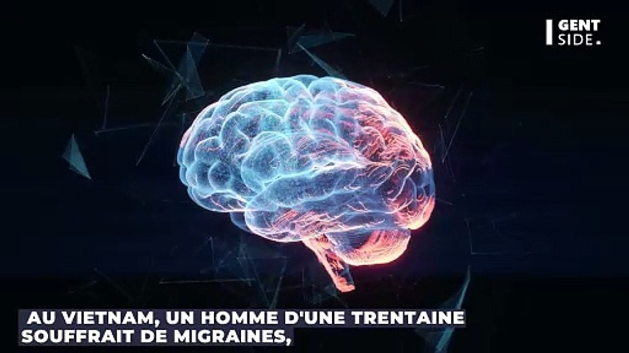Il se plaint de migraines, les médecins découvrent un objet dans son cerveau