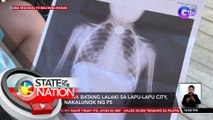 4-anyos na batang lalaki sa Lapu-Lapu City, Cebu, nakalunok ng P5 | SONA