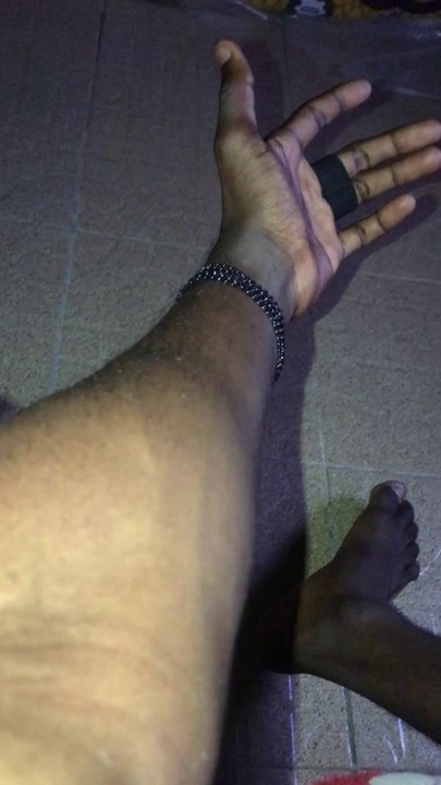 Damon Aura’s hand
