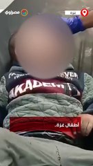 "أطفال غزة.. بنك أهداف الاحتلال".. إصابات خطيرة للأطفال جراء القصف الاسرائيلي على قطاع غزة