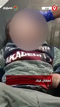 أطفال غزة.. بنك أهداف الاحتلال .. إصابات خطيرة للأطفال جراء القصف الاسرائيلي على قطاع غزة