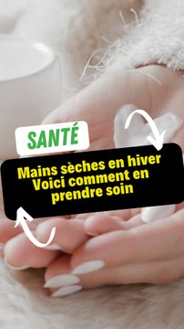 Mains sèches en hiver : Voici comment en prendre soin