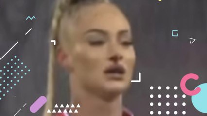 Alisha Lehmann told she’s ‘so brave, strong and sexy’ as she is left be BLOODIED nose in Switzerland game