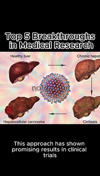 Top 5 Breakthroughs in Medical Research Unleashing Medical Miracles: Exploring #medicalresearch