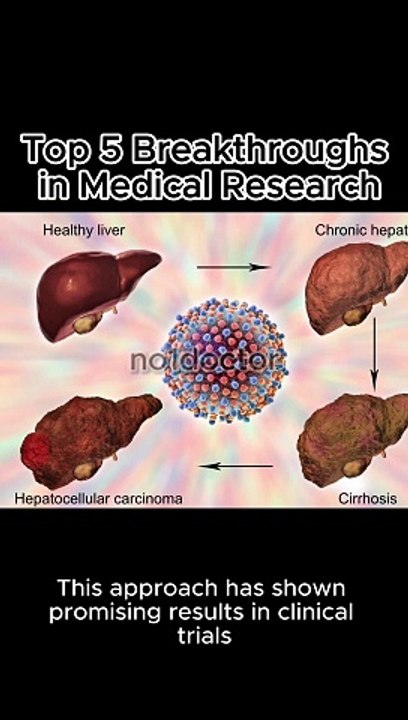 Top 5 Breakthroughs in Medical Research Unleashing Medical Miracles: Exploring  #medicalresearch