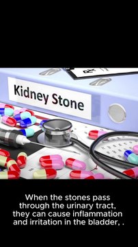 5 Symptoms and Signs of Kidney Stones