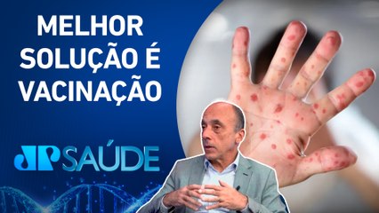Sarampo: Ainda não existe tratamento específico para vírus | JP SAÚDE