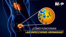 Así funcionan las bacterias que provocan infecciones urinarias - #ExclusivoMSP