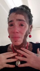 Artesã com vitiligo denuncia preconceito em shopping de Salvador: 'Disse que eu tava contaminando as pessoas'