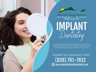 Implant Dentistry Callan Asheville NC