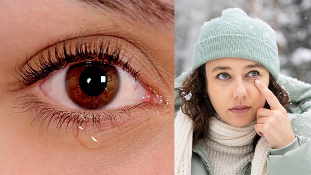 सर्दी में आँखों से पानी क्यों आता है | Watery Eyes In Winter Reason In Hindi| Boldsky