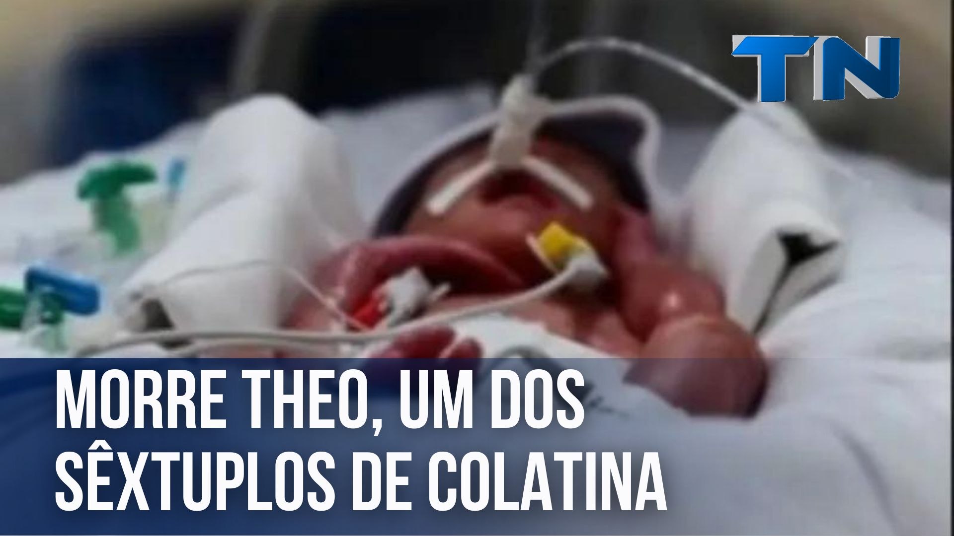 Morre Theo, um dos sêxtuplos de Colatina
