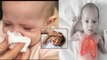 Pneumonia or Cold In Baby: निमोनिया या सर्दी बच्चों में कैसे पहचानें, Symptoms In Hindi | Boldsky