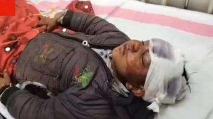 शिवपुरी: 6 वर्षीय मासूम को बाइक सवार ने कुचला, गंभीर हालत में उपचार जारी