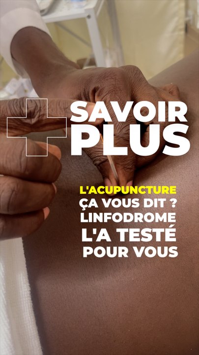 L'acupuncture ça vous dit ? Linfodrome l'a testé pour vous #short