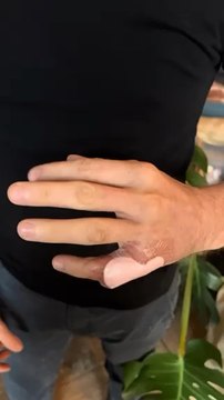 La réeducation est en cours ! Beaucoup de travail mais les progrés sont au rendez-vous J’ai hâte de pouvoir remettre les mains dans la terre ‍