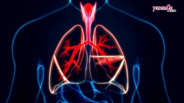 Beyaz Akciğer Sendromu nedir ve belirtileri nelerdir? Beyaz Akciğer Sendromu tedavisi nedir?