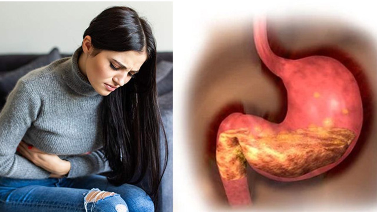 सर्दी में गैस ज्यादा क्यों बनती है | Does Cold Weather Cause Gas In Stomach | Boldsky