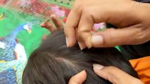 Remove all hundred lice from hair - Get out head lice from short hair