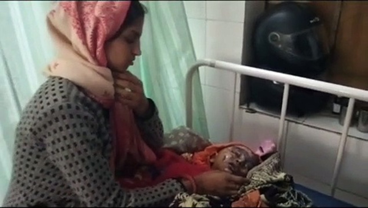 खौलते तेल की कड़ाई में गिरने से मासूम झुलसा, देखें वीडियो...
