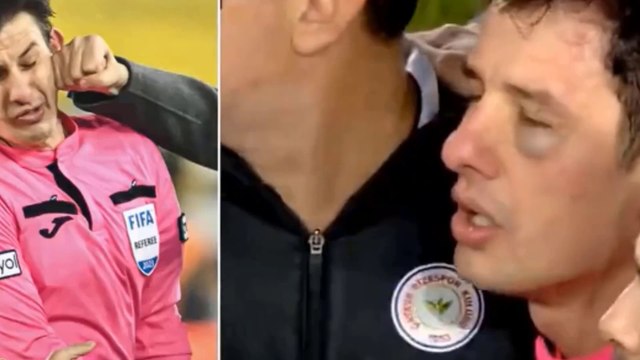 Turkish Referee Discharged from Hospital After Being Viciously Punched by Club Team President