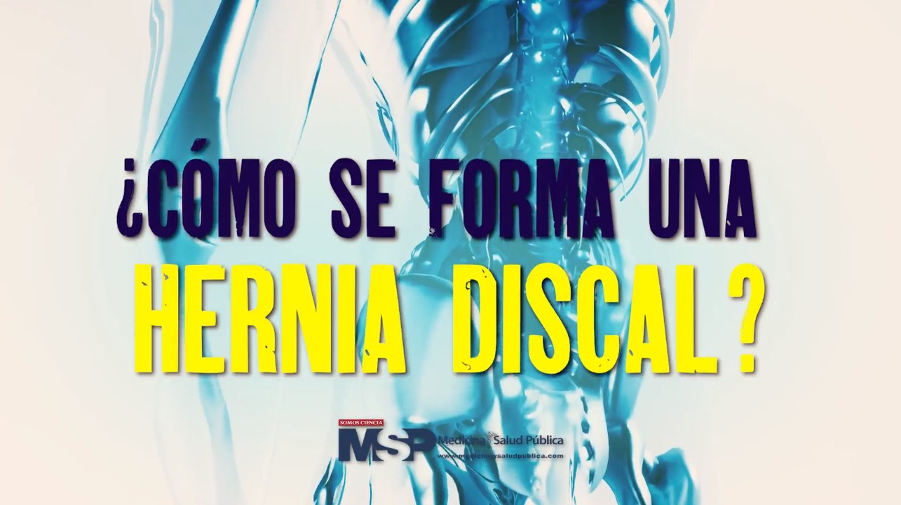 ¿Cómo se forma una hernia discal?