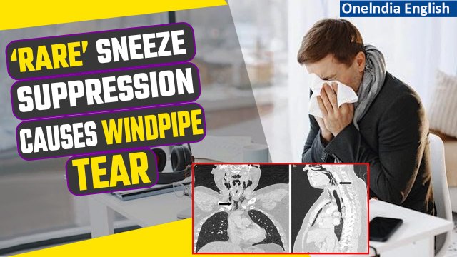 World's First Case: Man Tears his Windpipe from Suppressing Sneeze, Rushed to Hospital | Oneindia