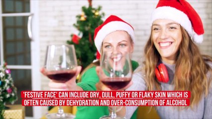 How to avoid 'festive face' this Christmas