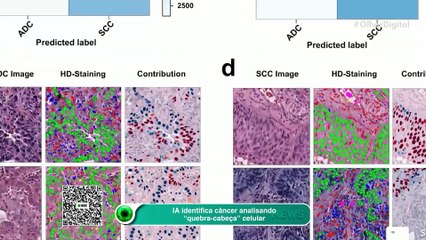 IA identifica câncer analisando “quebra-cabeça” celular