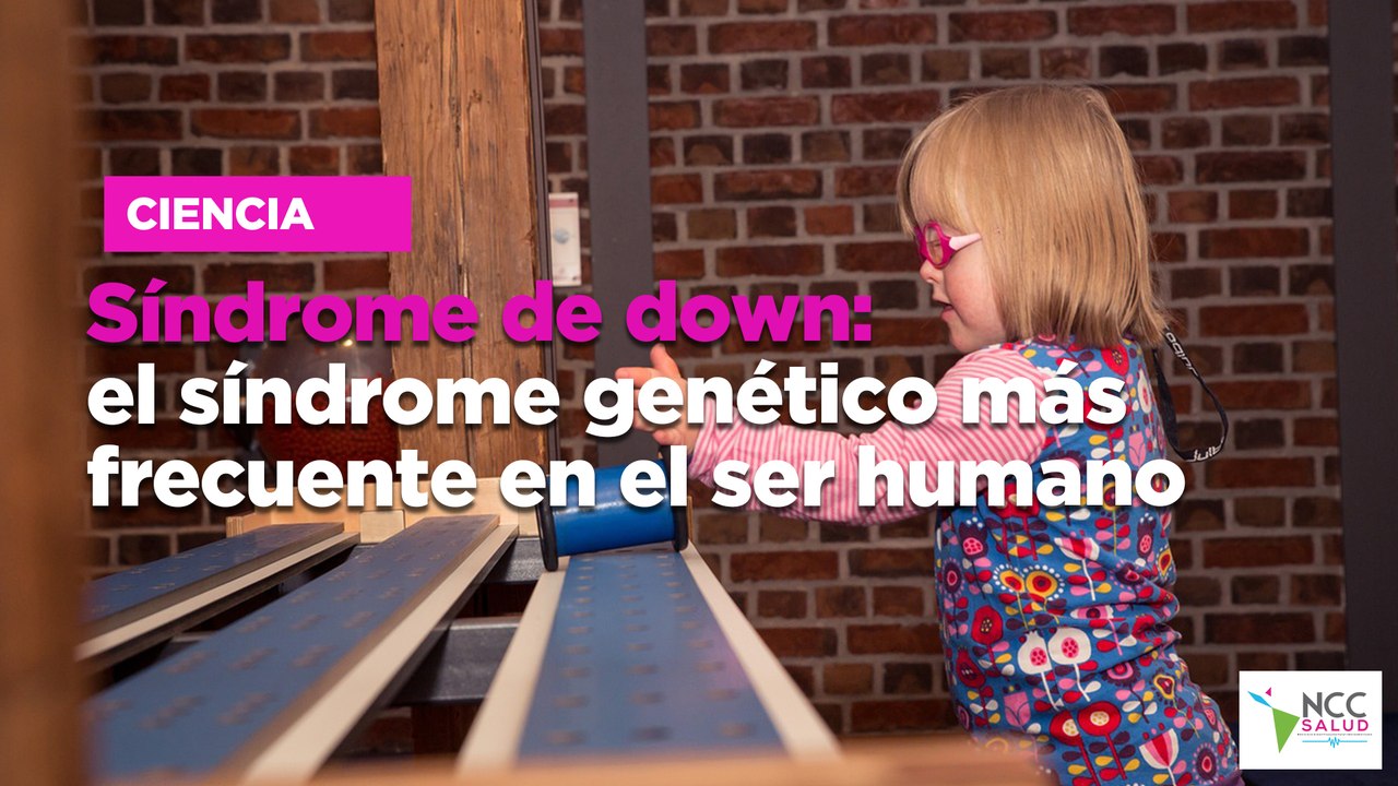 Síndrome de down: el síndrome genético más frecuente en el ser humanSíndrome de down: el síndrome genético más frecuente en el ser humano