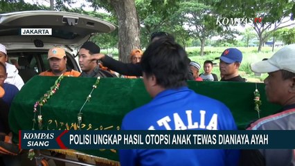 Polisi Ungkap Hasil Otopsi Anak Tewas Dianiaya Ayah: Alami Patah Tulang Tengkorak
