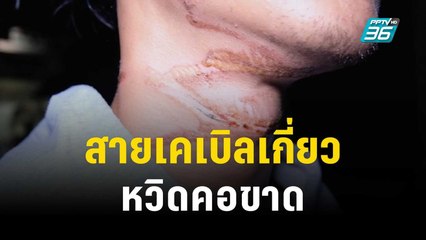หนุ่มโบลต์ โวย สายเคเบิลเกี่ยวหวิดคอขาด | เที่ยงทันข่าว | 18 ธ.ค. 66