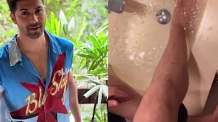 Varun Dhawan injured during the shooting of film! shared picture of his leg