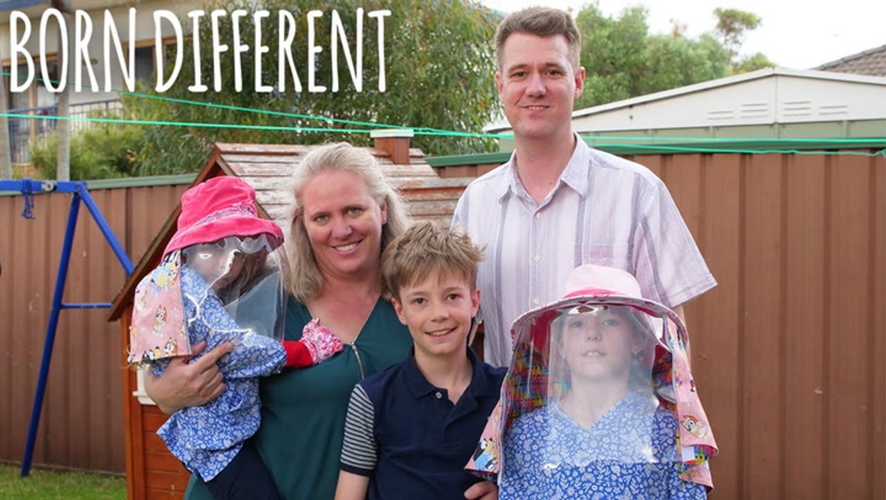 We Are Allergic To Sunlight | BORN DIFFERENT