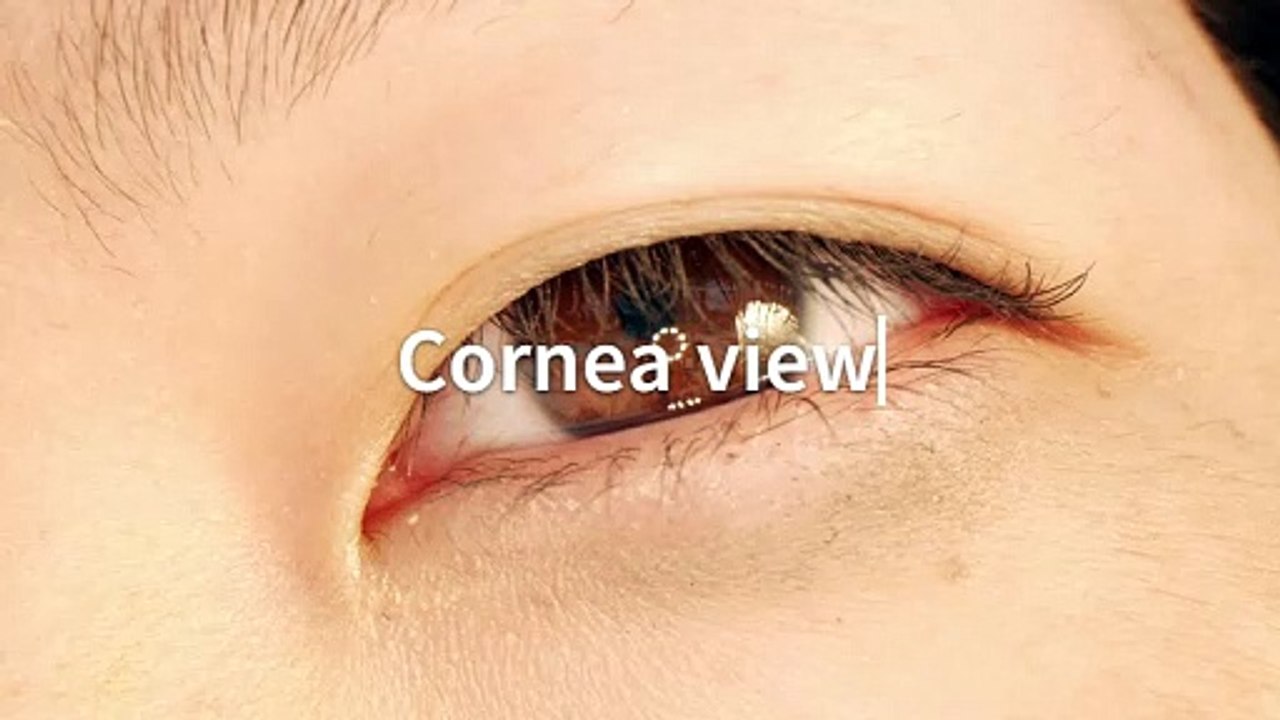 cornea view
