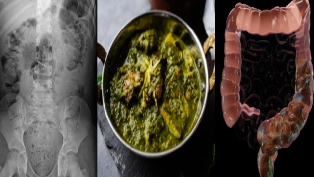 Raat Ko Saag Khana Chahiye Ya Nahi | Saag Ki Taseer Garam Ya Thandi | Boldsky