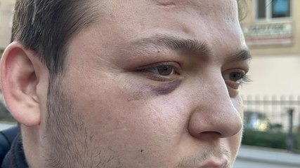 Ataşehir'de motokuryeye darp kamerada