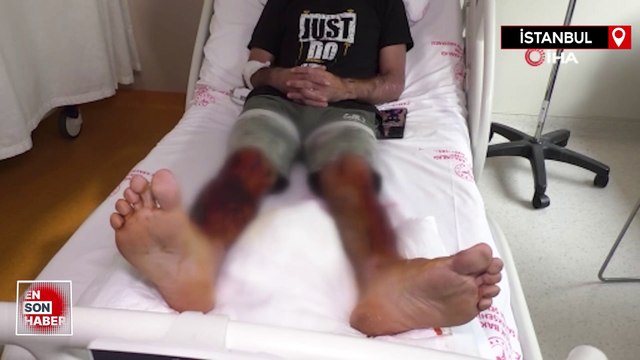 İstanbul'da lavabo açıcı bomba gibi patladı