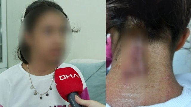 Bahçelievler'de maganda kurşunu 11 yaşındaki kızın boynuna isabet etti