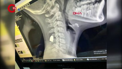 Bahçelievler'de dehşet: Maganda kurşunu 11 yaşındaki çocuğun boynuna isabet etti!