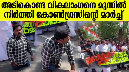 വികലാംഗനെ മുന്നിൽ നിർത്തി കോൺഗ്രസ്സിന്റെ പ്രതിഷേധ മാർച്ച്