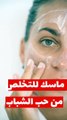 ماسك علاج حب الشباب _ طبيعي 100