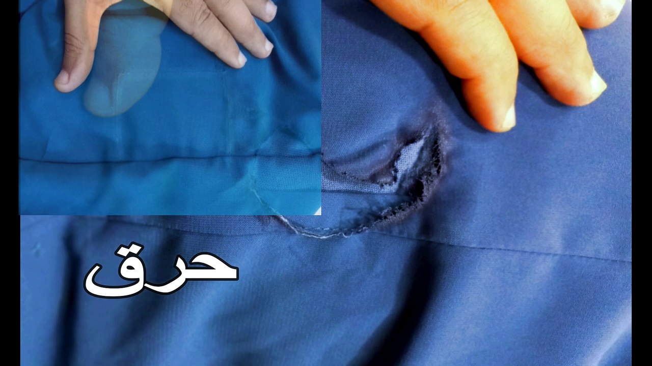An amazing way to repair a burn in a jilbab beautifully.