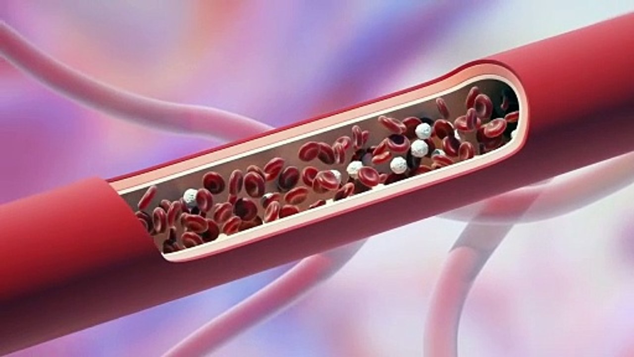 FIVE UNEXPECTED I Signs of Heart Disease I THAT YOU MUST KNOW!